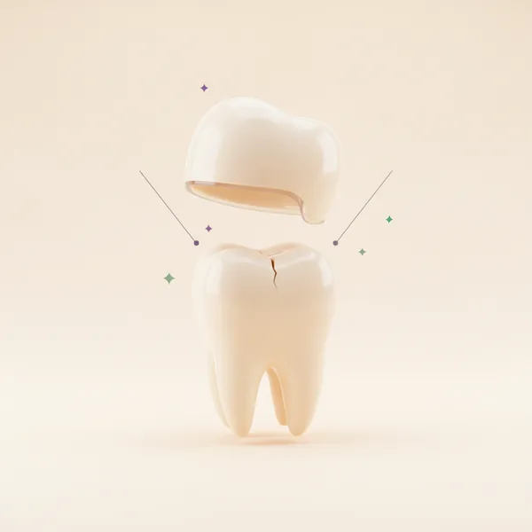 Coronas y Puentes en TAND Clínica Dental, Querétaro