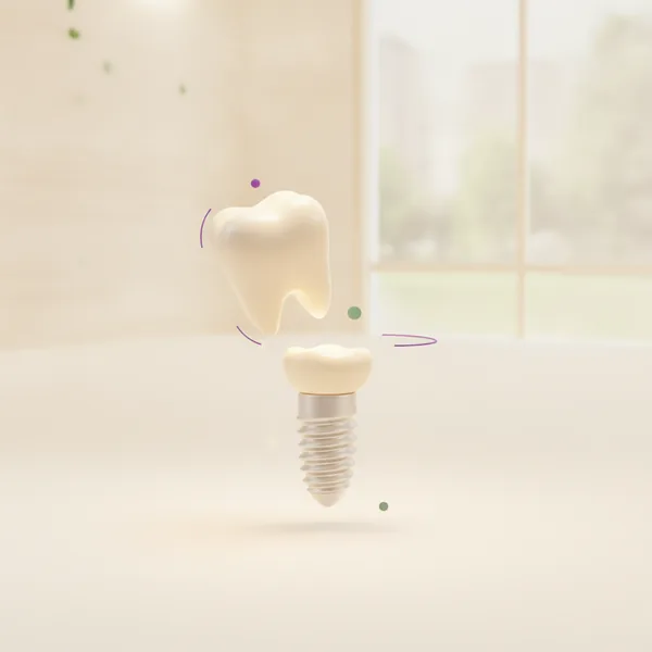 Implantes Dentales en TAND Clínica Dental, Querétaro